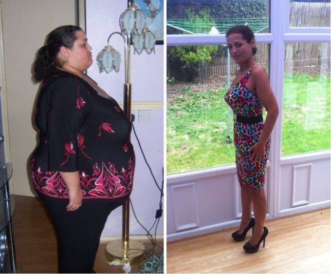 Fitness Motivation Morbidly Obese Woman Rejects Gastric Band Op Loses 20st The Old Fashi 